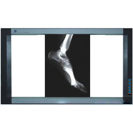 Holographic Medical Imaging Film, Thermal Printer, PET X Ray Film