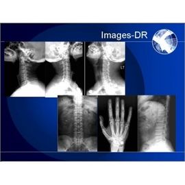 DR Radiography ระบบดิจิตอลพกพาแบบพกพาระบบ Mammogrpahy X-RAY
